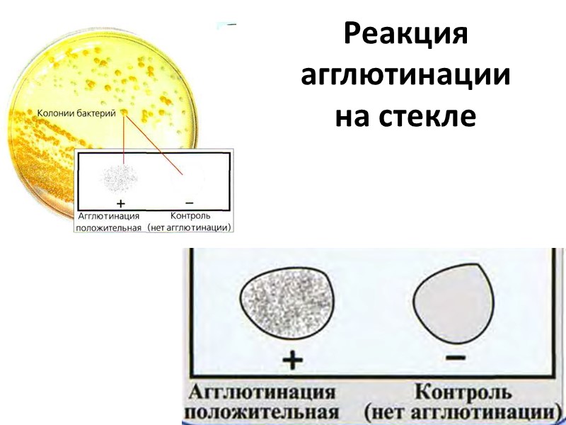 Реакция агглютинации на стекле